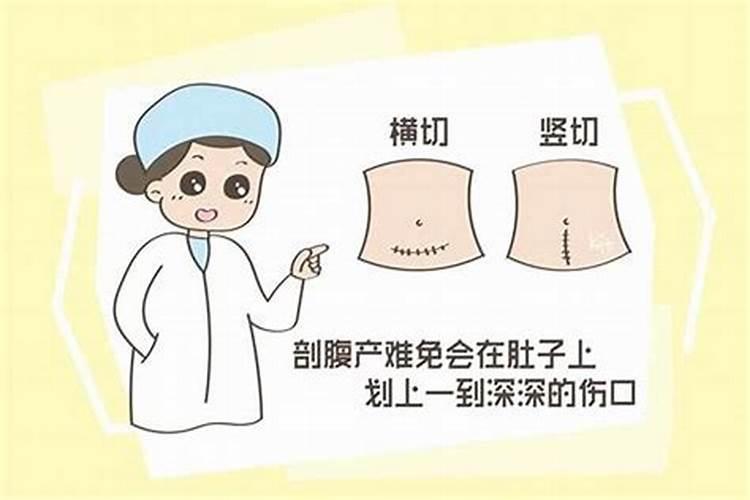 剖腹产要看日子吗