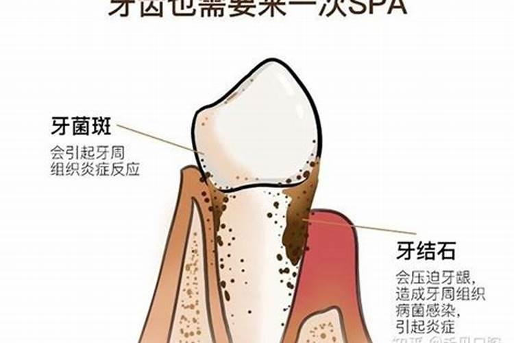 为什么冲太岁要洗牙