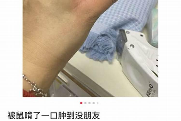 女人梦见自己打老鼠被老鼠咬伤