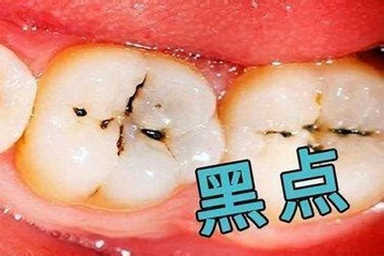 什么八字的人牙齿容易坏