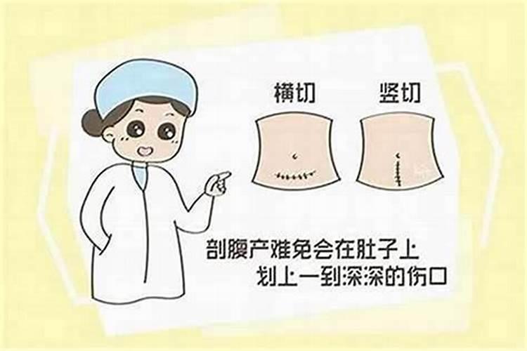 剖腹产算八字准不准