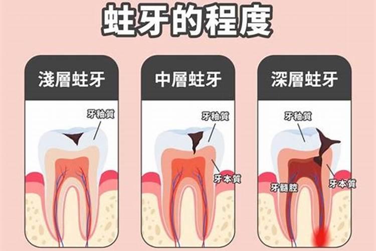 梦见牙痛蛀牙