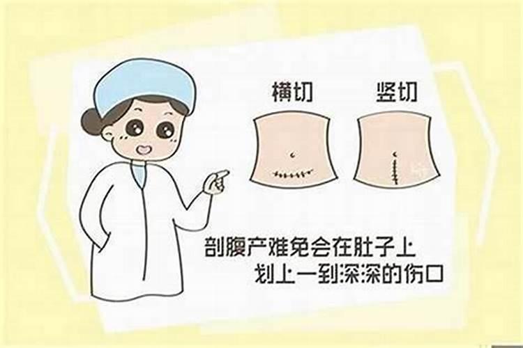 剖腹产怎么算命