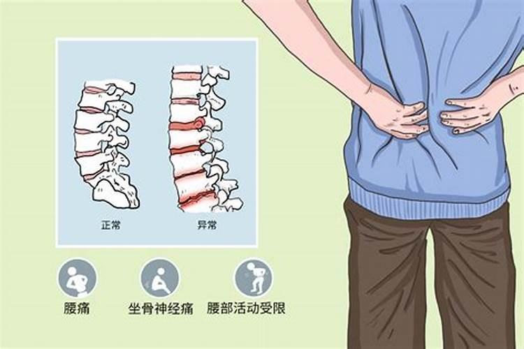 八字看腰椎病