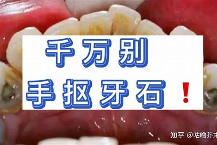 梦见自己抠牙结石掉落