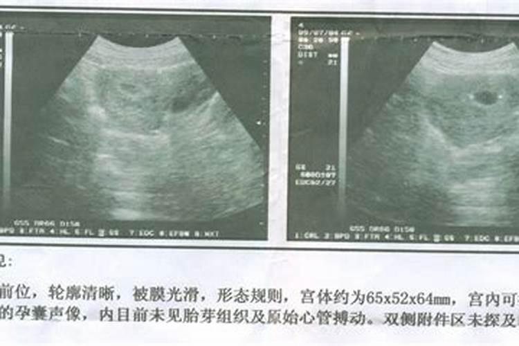 单身中年女人梦见陌生男人想拥抱我拒绝了是什么预兆