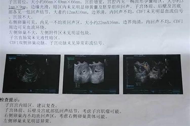 给逝去的亲人超度怎么写