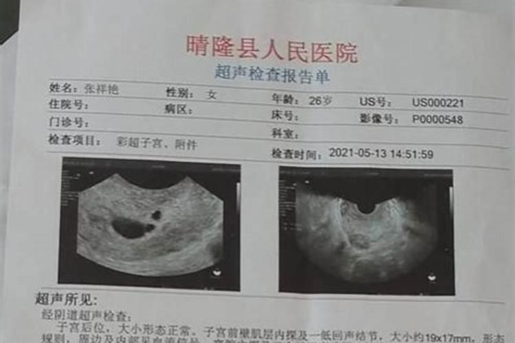 两个属兔的可以结婚吗