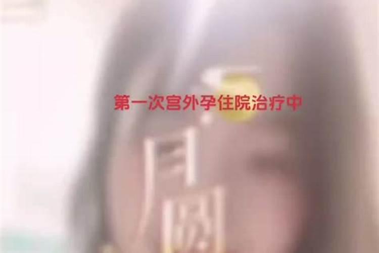 孕晚期做梦梦见孩子生出后有缺陷